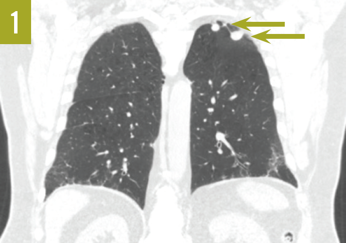 A Collection of Conditions Affecting the Lungs Consultant360